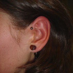 piercing_skinetik_Anthelix_01