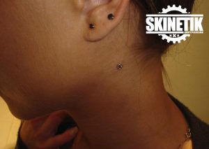 piercing_skinetik_micro_dermal104