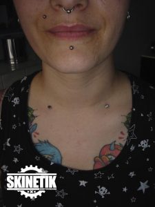 piercing_skinetik_micro_dermal111