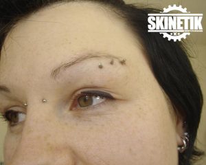 piercing_skinetik_micro_dermal122