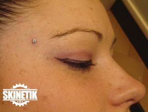 piercing_skinetik_micro_dermal18