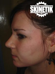 piercing_skinetik_micro_dermal32