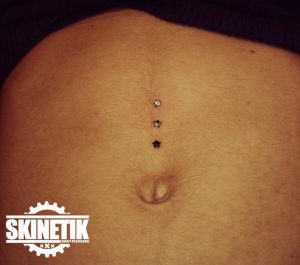 piercing_skinetik_micro_dermal35
