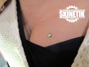 piercing_skinetik_micro_dermal61