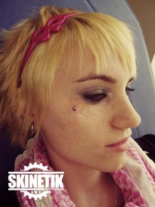 piercing_skinetik_micro_dermal63