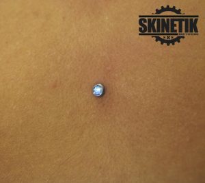 piercing_skinetik_micro_dermal67