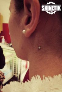 piercing_skinetik_micro_dermal75