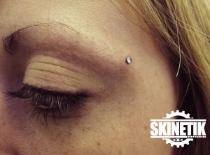 piercing_skinetik_micro_dermal80
