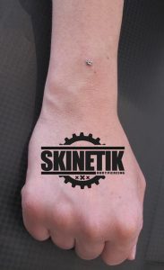 piercing_skinetik_micro_dermal92