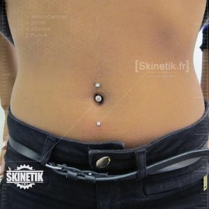 microdermal