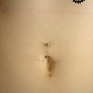 piercing_skinetik_surface_Navel_02