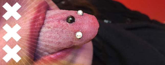 Peut on se faire un piercing buccal avec un appareil dentaire ?