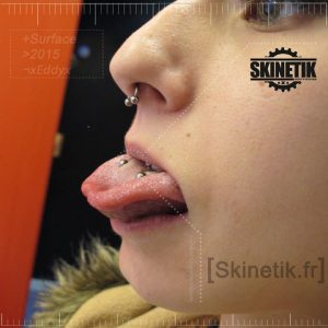 skinetik