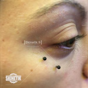 skinetik