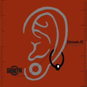 Skinetik